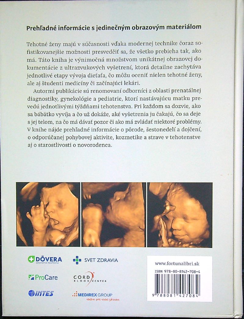Tehotenstvo v obrazoch